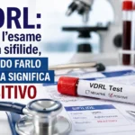vdrl esame sifilide